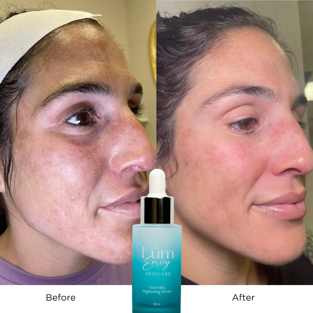 LÚMENVY® SKINCARE Glass Skin Brightening Serum